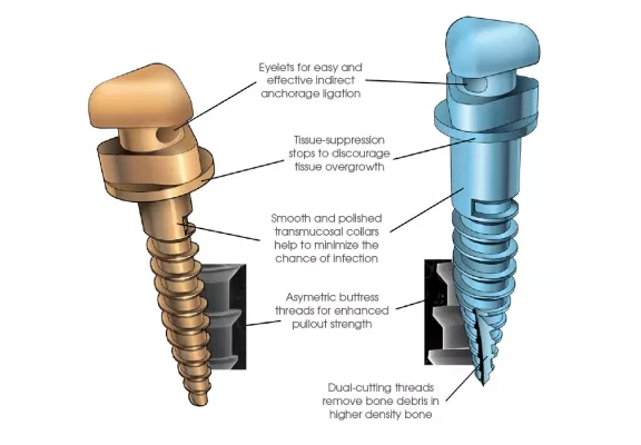 Ormco VectorTAS 12MM10MM8MM6MM MINI-SCREW-PK6