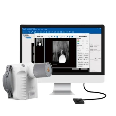 1 Set Dental Imaging System Intraoral Digital Dental Sensor APS CMOS