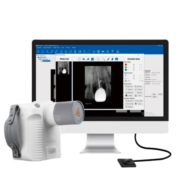 1 Set Dental Imaging System Intraoral Digital Dental Sensor APS CMOS