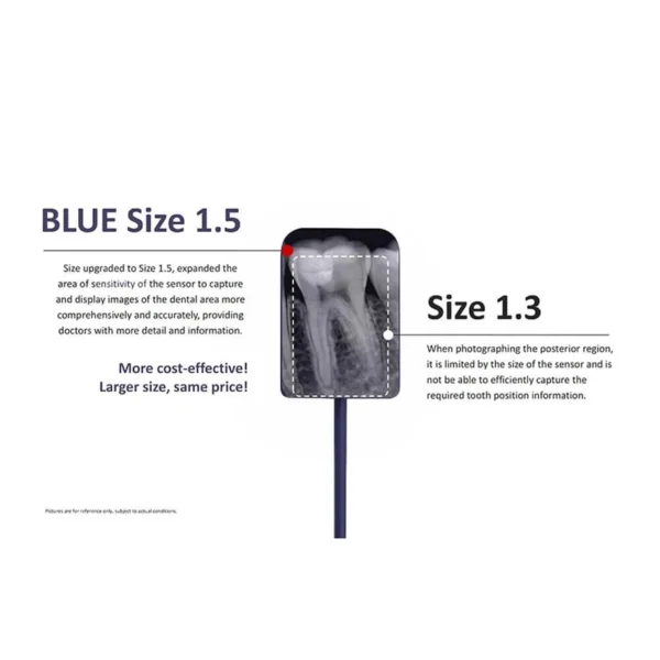 1 Set Dental Imaging System Intraoral Digital Dental Sensor APS CMOS